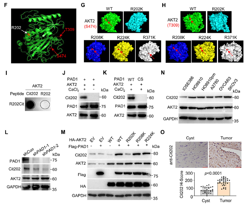  PAD1在R202位點(diǎn)對AKT2的瓜氨酸化促進(jìn)OC細(xì)胞中AKT2酶活性