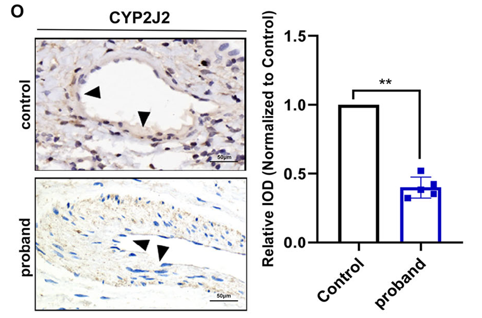 AtaGenix為本研究定制了 CYP2J2 抗體，用于免疫印跡和免疫組化實驗